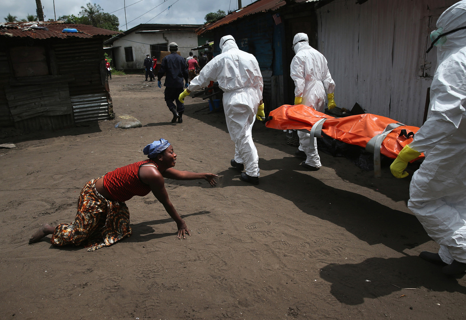 伊波拉病毒感染者图片图片